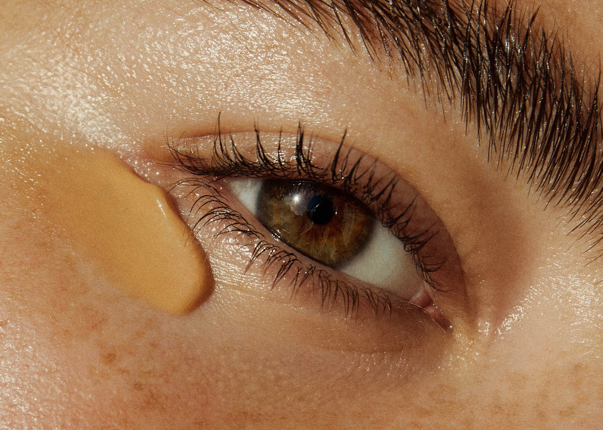 Under Eye Care: Reducing Puffiness and Dark Circles