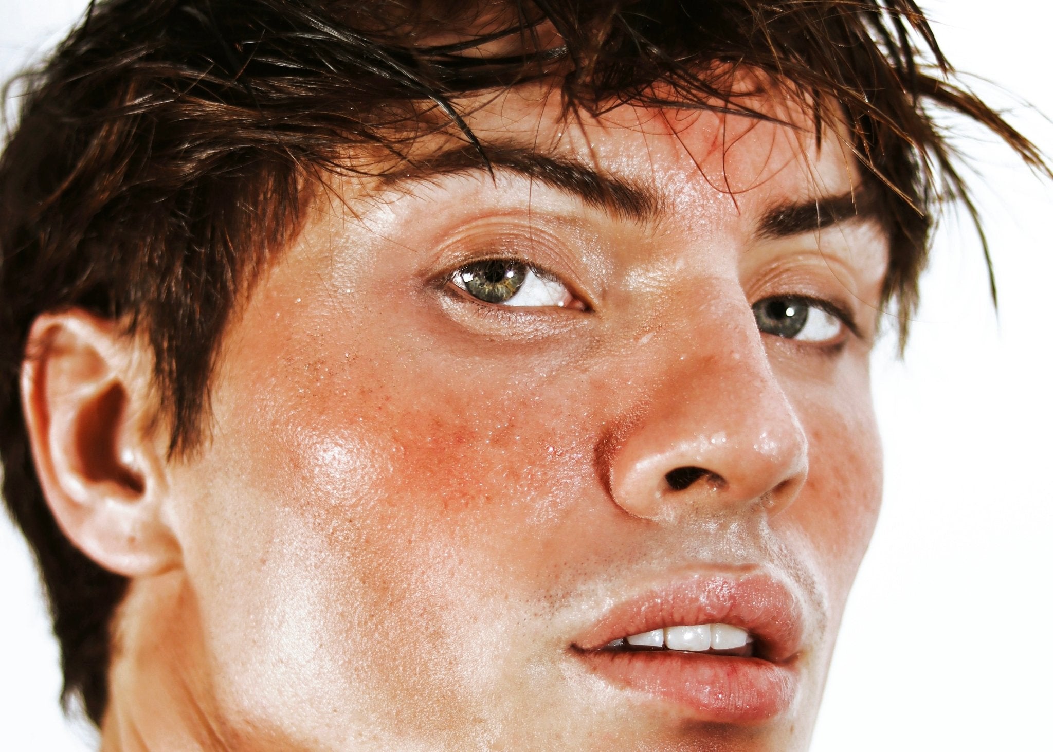 Can Retinol Cause Redness? Tips for Managing Skin Irritation Amala